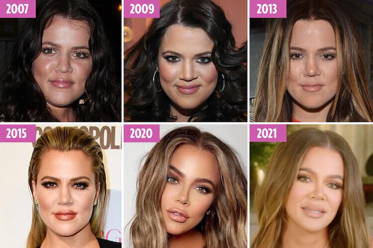 Δείτε πόσο άλλαξε η Khloe Kardashian